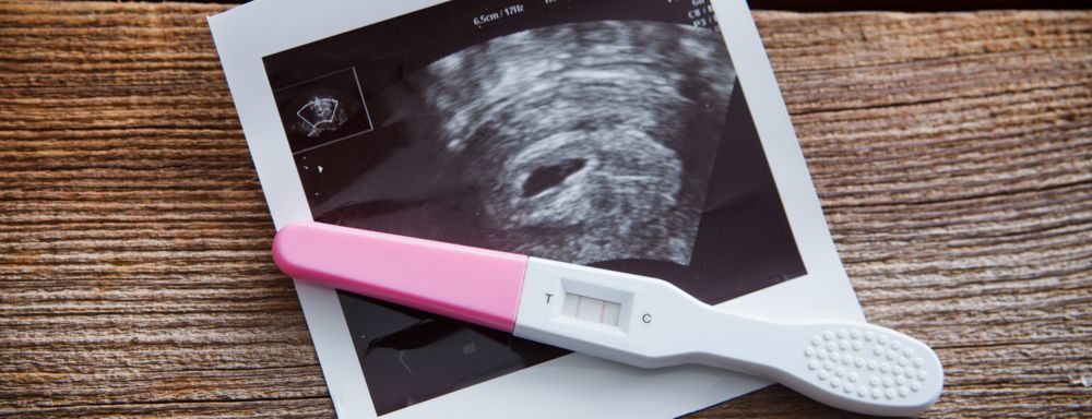 Schwangerschaftstest und Ultraschallbild